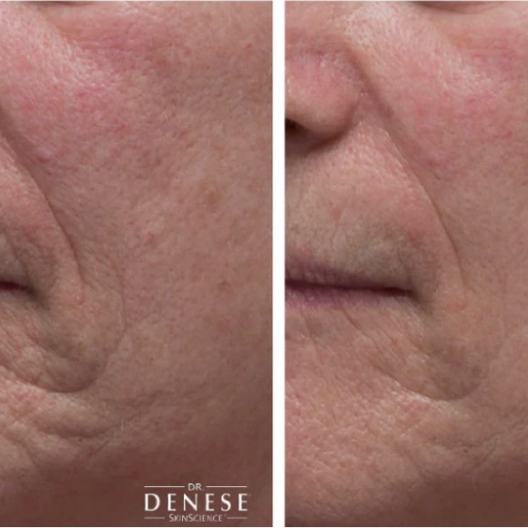 NEW DR. DENESE COLLAGEN FIRMING PEEL OFF MASK 120ml - Picture 3 of 3